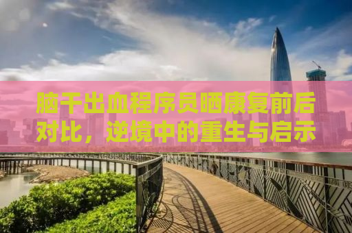 脑干出血程序员晒康复前后对比，逆境中的重生与启示